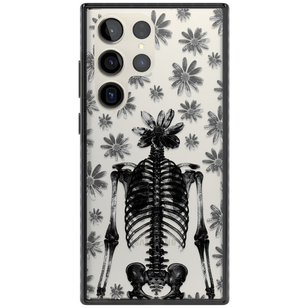 Skeleton Flower