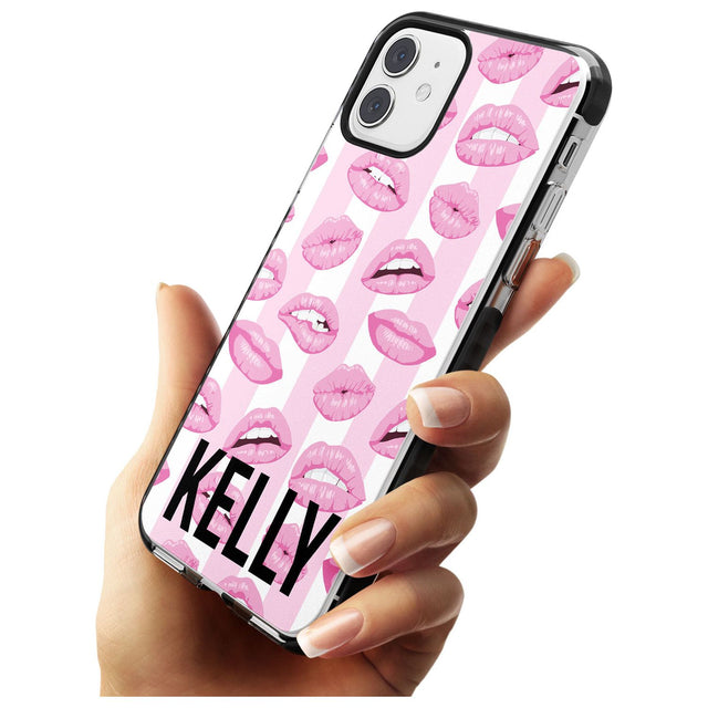 Pink Stripes & Lips iPhone Case   Custom Phone Case - Case Warehouse